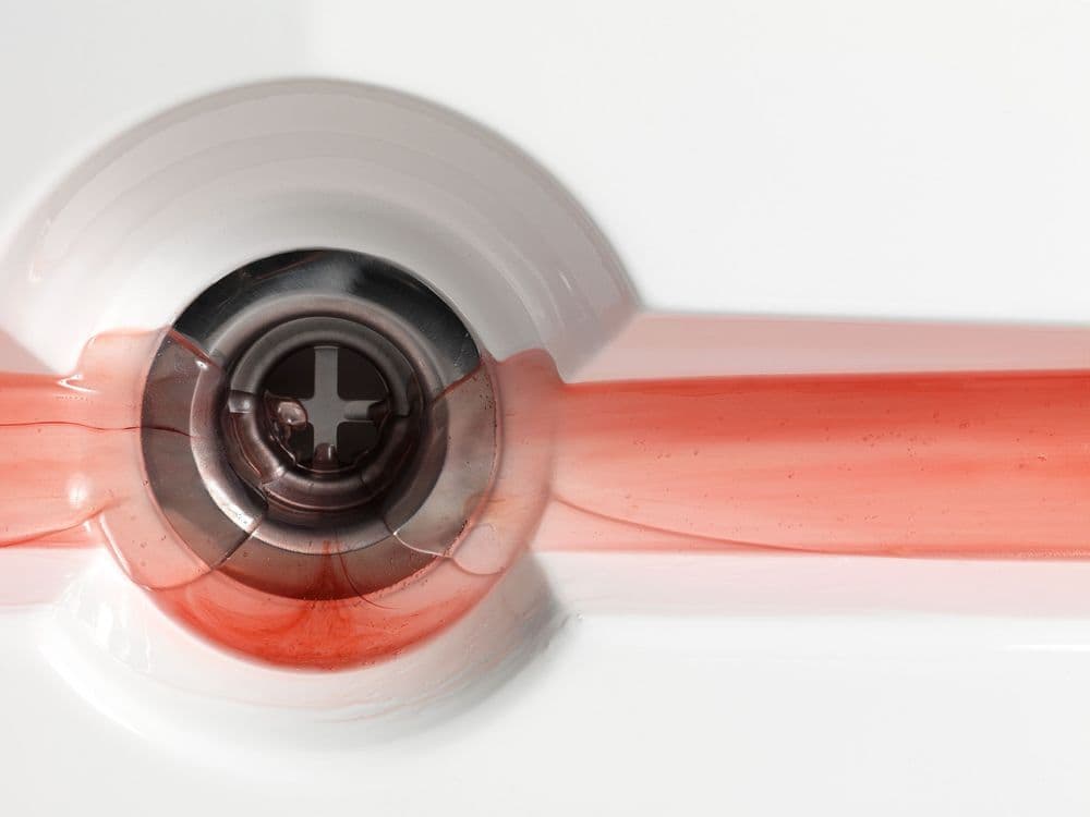 Kara Tanaka, "A Sad Bit of Fruit, Pickled in the Vinegar of Grief", 2010-2011, detail © Kara Tanaka | ph. Dario Lasagni